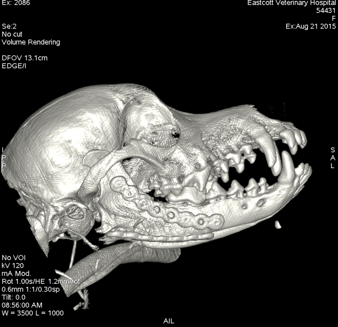 Maxillo facial fracture CTafter sugery
